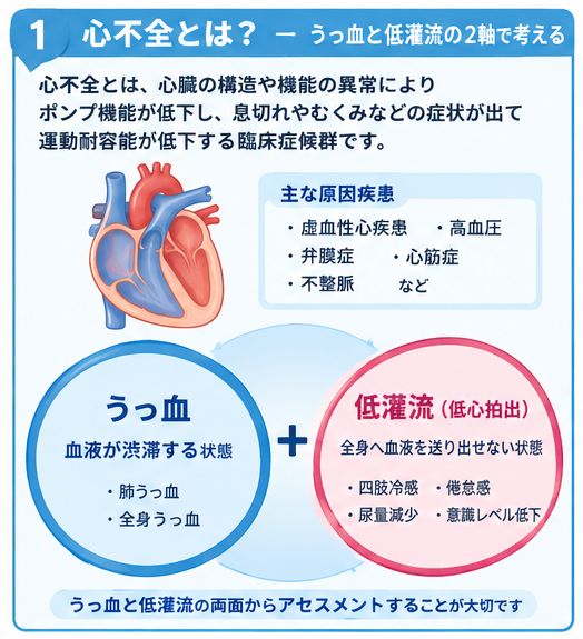 心不全とは？うっ血と低灌流の2軸で考える図