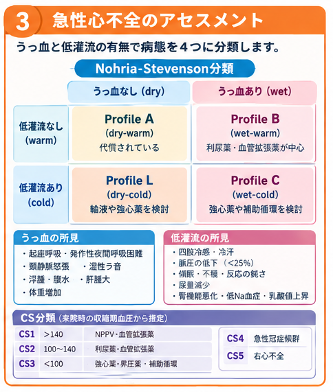急性心不全のアセスメント（Nohria-Stevenson分類・CS分類）の図